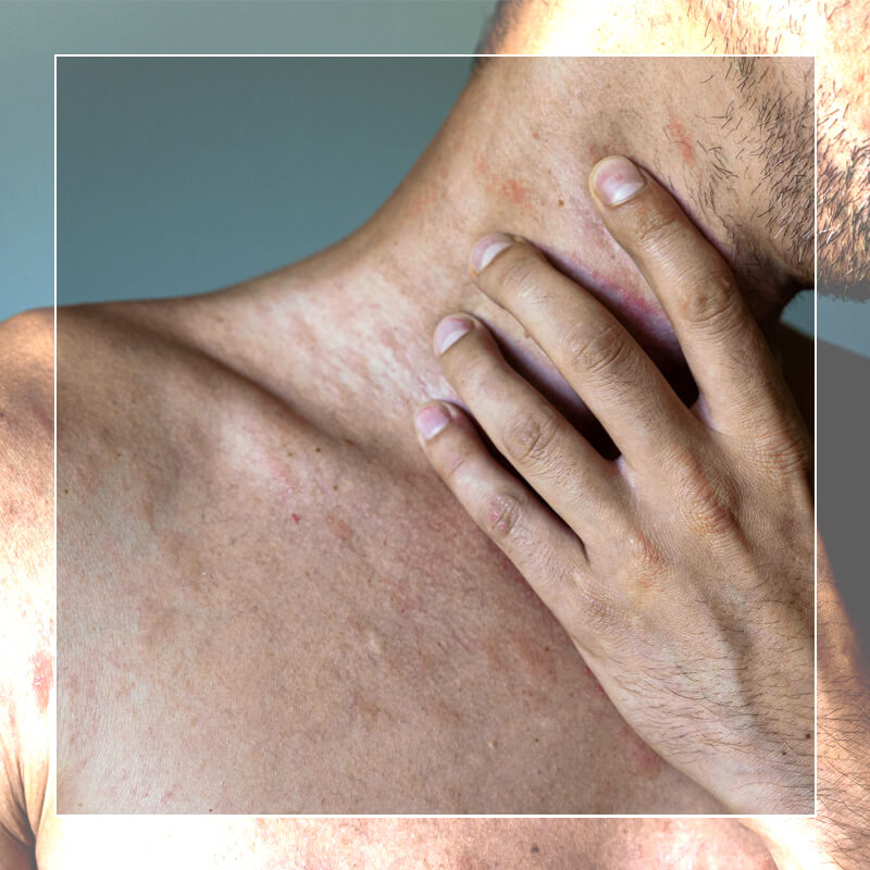 Topicann Crema con CBD e CBG